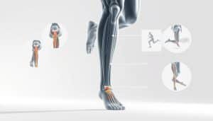 running biomechanics factors