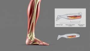 A detailed biomechanical illustration of a human leg performing a neurodynamic slider technique. In the foreground, the leg is shown mid-movement, with the knee bent and the foot pointing outward, revealing the intricate muscle and tendon structures. The middle ground showcases a cross-sectional view of the leg, highlighting the sliding motion of the nerves through the various tissue layers. In the background, a schematic diagram outlines the biomechanical principles and range of motion involved in the slider technique. The image is captured with a clean, technical aesthetic, utilizing sharp lighting and a neutral color palette to emphasize the anatomical details.